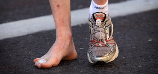 pies lesionados running