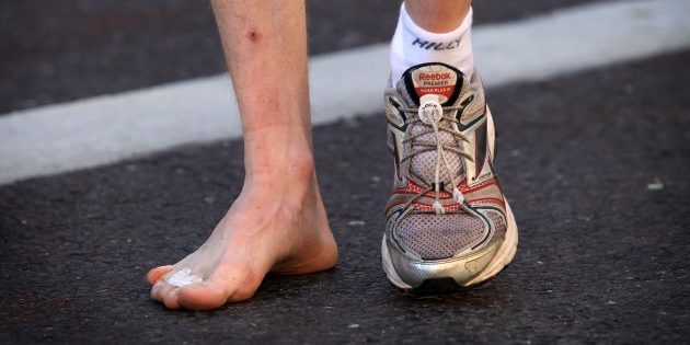 pies lesionados running